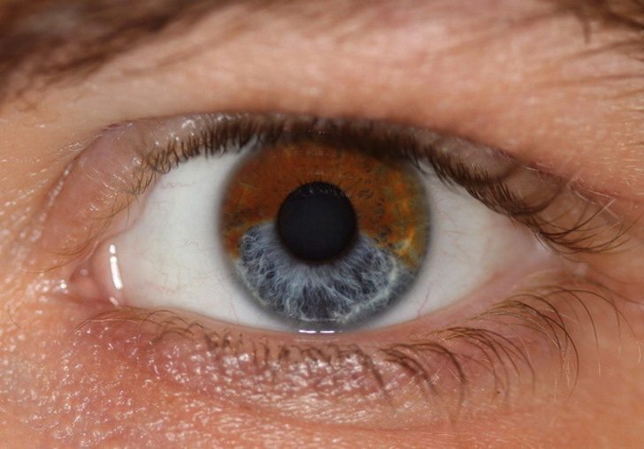 تغير لون العينين أسطورة حقائق صادمة لا تعرفها عن دور حالتك