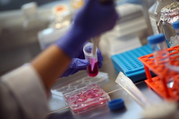 اختبار الأجسام المضادة