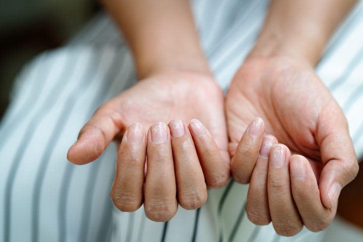 ISTOCK \ الأظافر