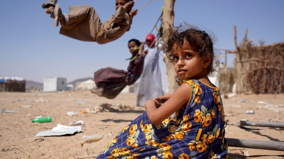 اليمن المجاعة الفاو العالم العربي