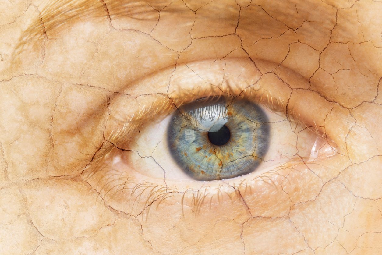 جفاف العين والصداع ما العلاقة التي تجمع بينهما كل يوم معلومة طبية