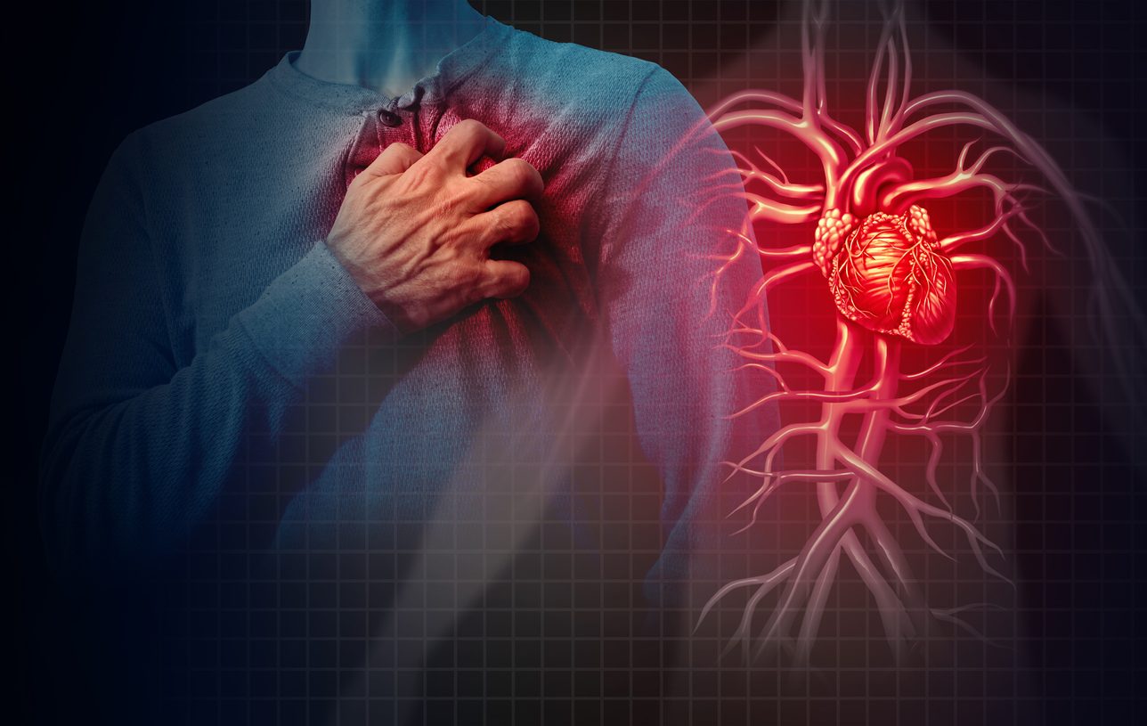 iStock/ السكتة القلبية هي حالة يتوقف فيها القلب فجأة عن ضخ الدم باتجاه الجسم ويحدث ذلك عند حدوث مشكلة في الإشارات الكهربائية في القلب.