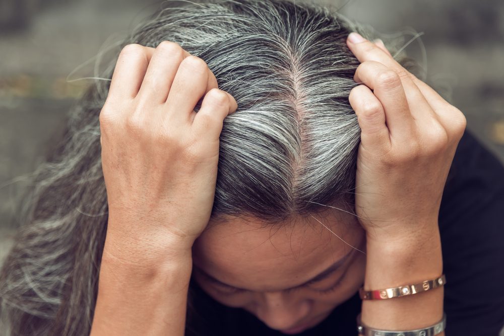يتحوّل الشعر إلى رماديّ بسبب قلّة إنتاج الميلانين / shutterstock