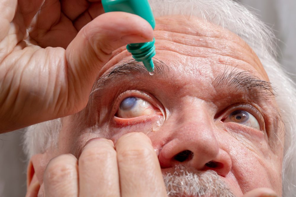 الشيخوخة عامل أساسي في الإصابة بالجلوكوما/ Shutterstock