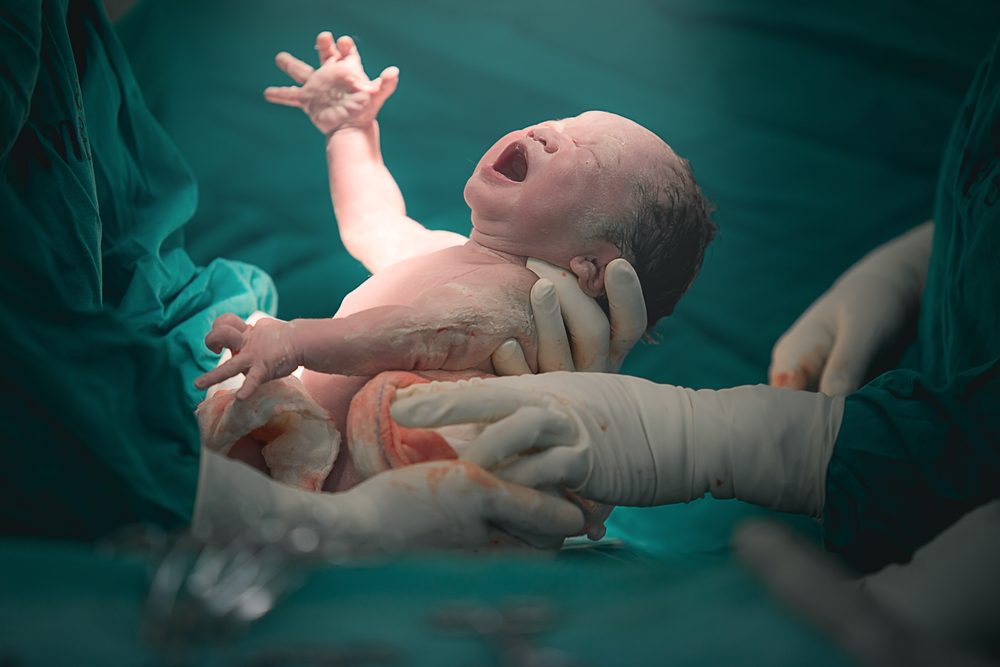 تُعد عملية الولادة صدمة قاسية بالنسبة للمولود الجديد- Shutterstock