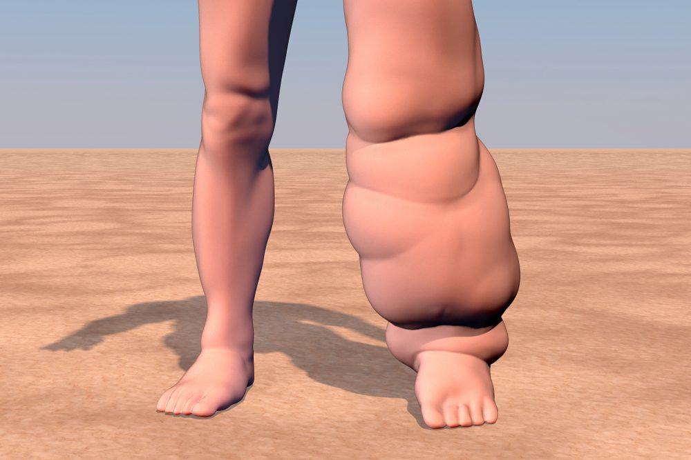 <strong>التشخيص والعلاج </strong>/ Shutterstock