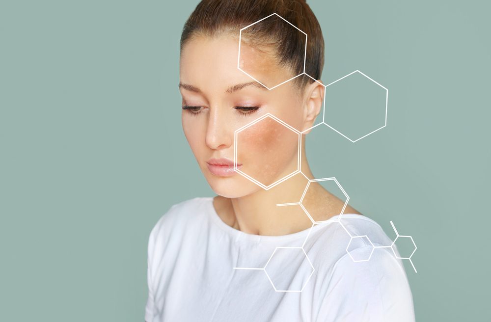 تحدث تغيرات الجلد ولونه بسبب الهرمونات المصاحبة لفترة الحمل - ShutterSTock