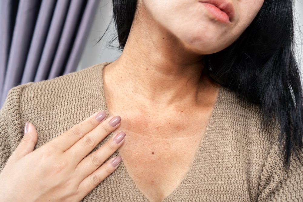عادة ما تزول التغيرات الجلدية من تلقاء نفسها بعد الولادة - shutterStock