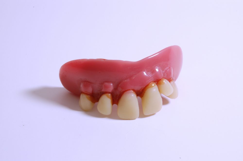 الأسنان البشعة| shutterstock