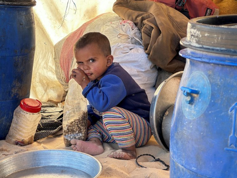 الأطفال في غزة مهددين بخطر الجوع- الأناضول