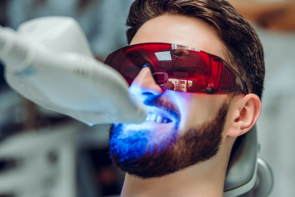 تبييض الأسنان بالليزر| shutterstock